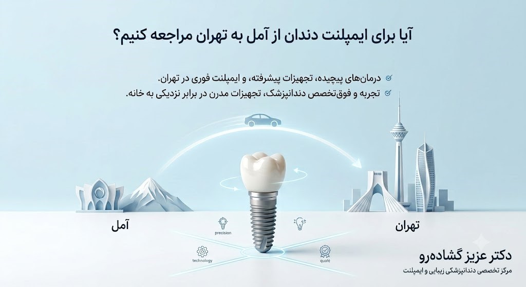 آیا برای ایمپلنت دندان از آمل به تهران مراجعه کنیم؟