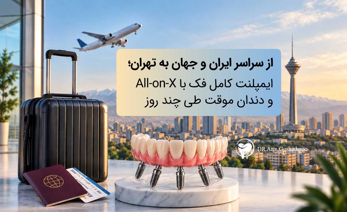 از سراسر ایران و جهان به تهران؛ ایمپلنت کامل فک با All-on-X و دندان موقت طی چند روز