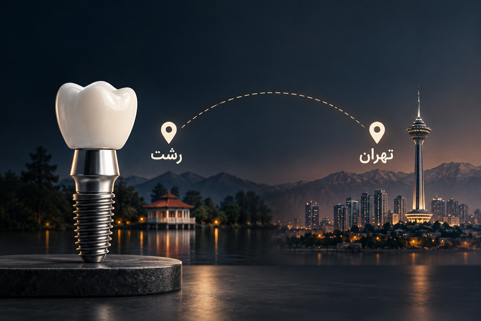 ایمپلنت دندان در رشت؛ درمان در رشت بهتر است یا مراجعه به تهران؟