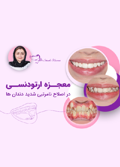 خدمات VIPارتودنسی