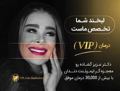 ایمپلنت فوری دندان در تهران