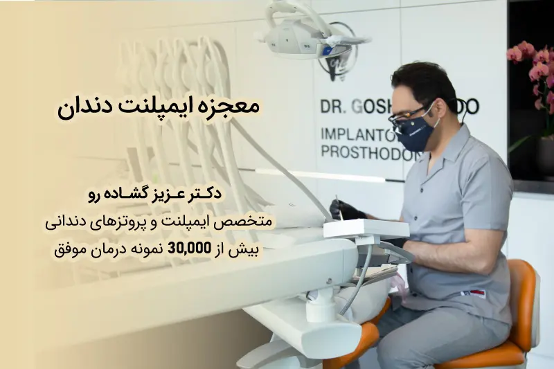 متخصص ایمپلنت فوری دندان در تهران