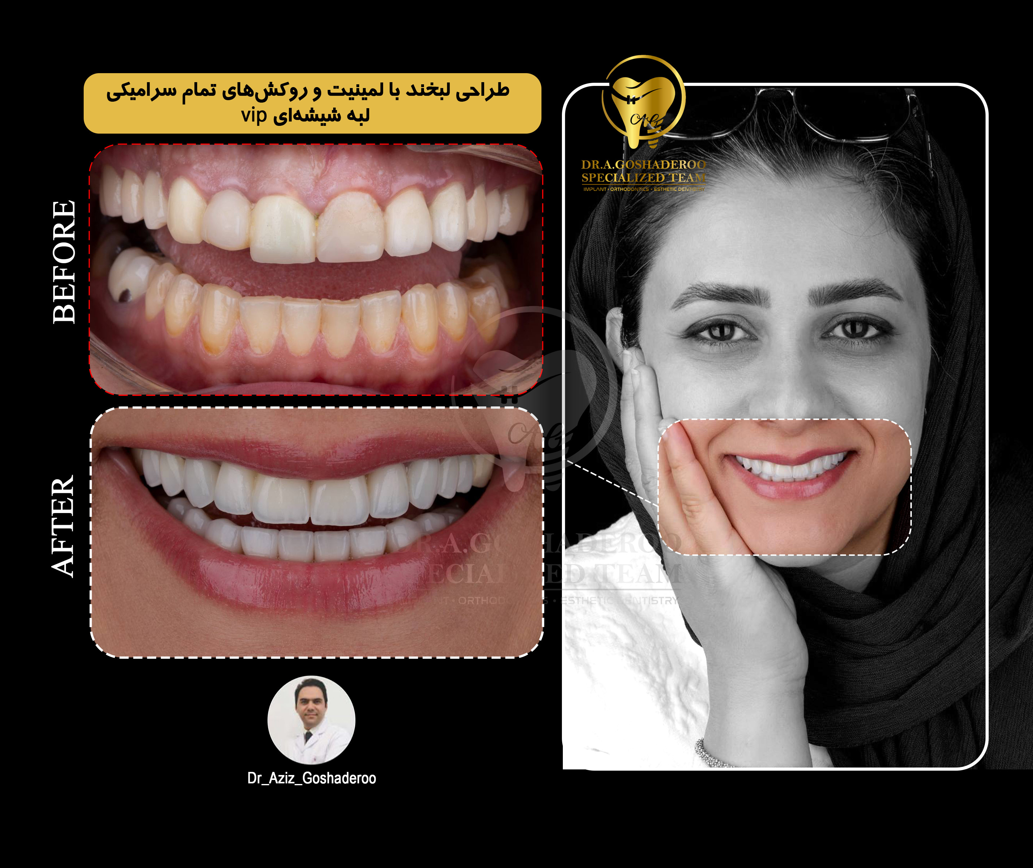 دندانپزشکی زیبایی چیست؟