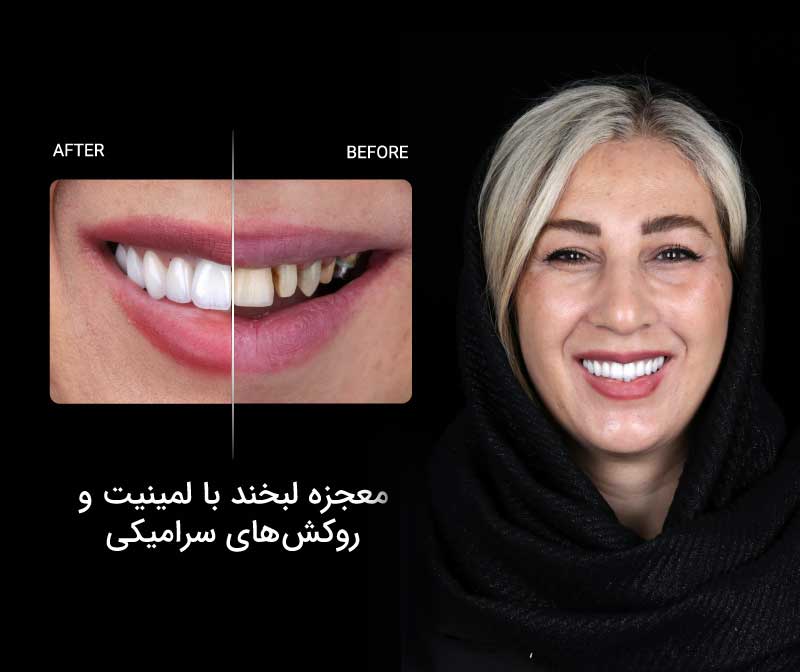 خدمات دندانپزشکی زیبایی شامل چه درمان‌هایی است؟