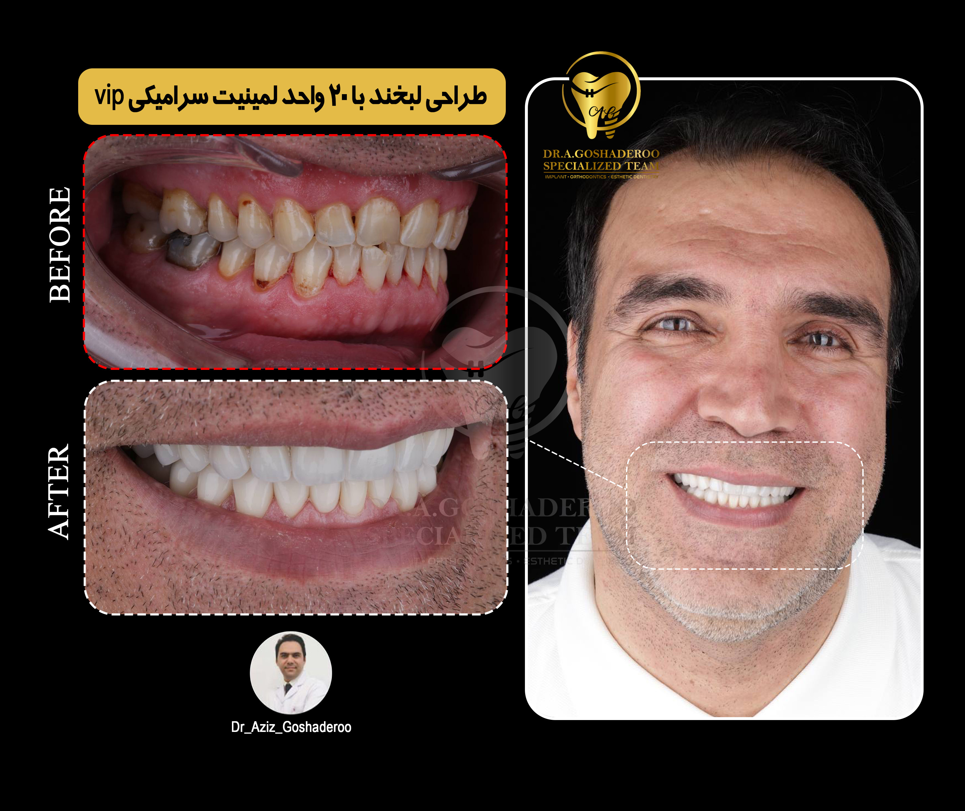 طراحی لبخند