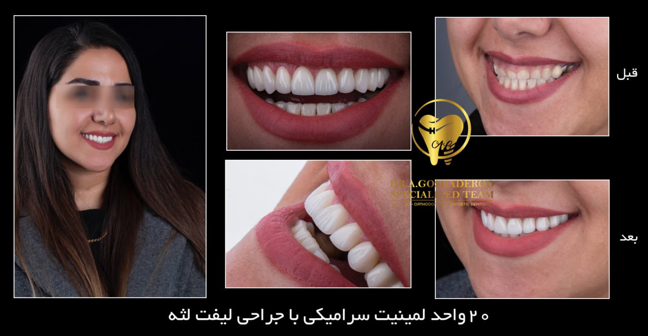 چه مشکلاتی با دندانپزشکی زیبایی قابل اصلاح است؟