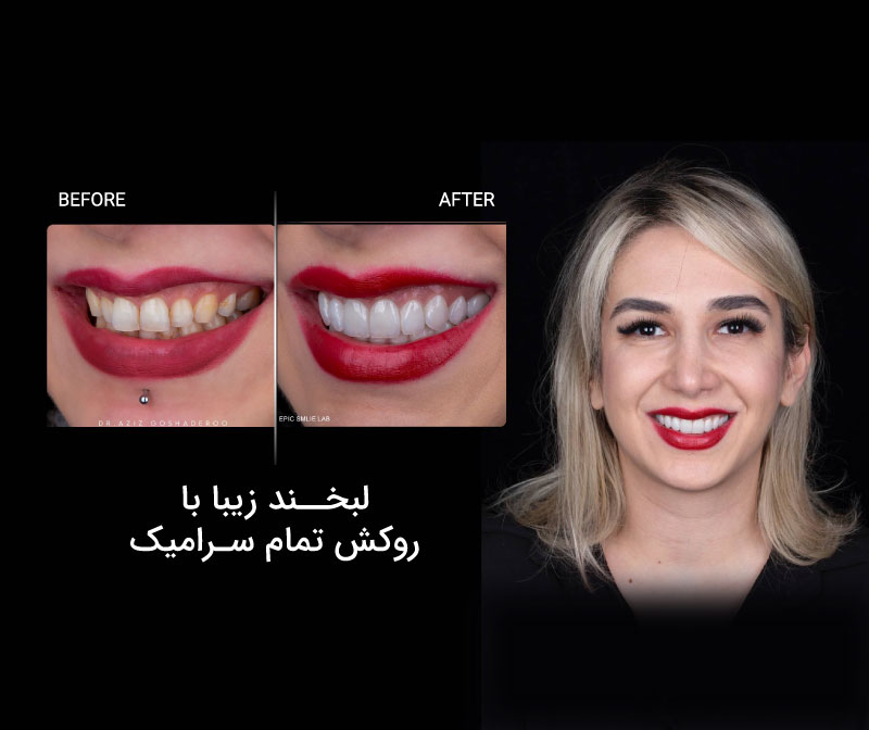 نتیجه طبیعی در دندانپزشکی زیبایی به چه عواملی بستگی دارد؟