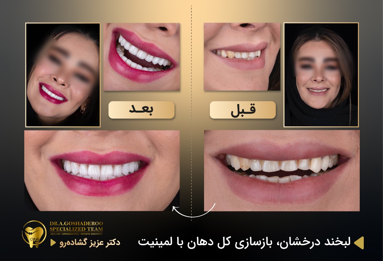 دندانپزشکی زیبایی