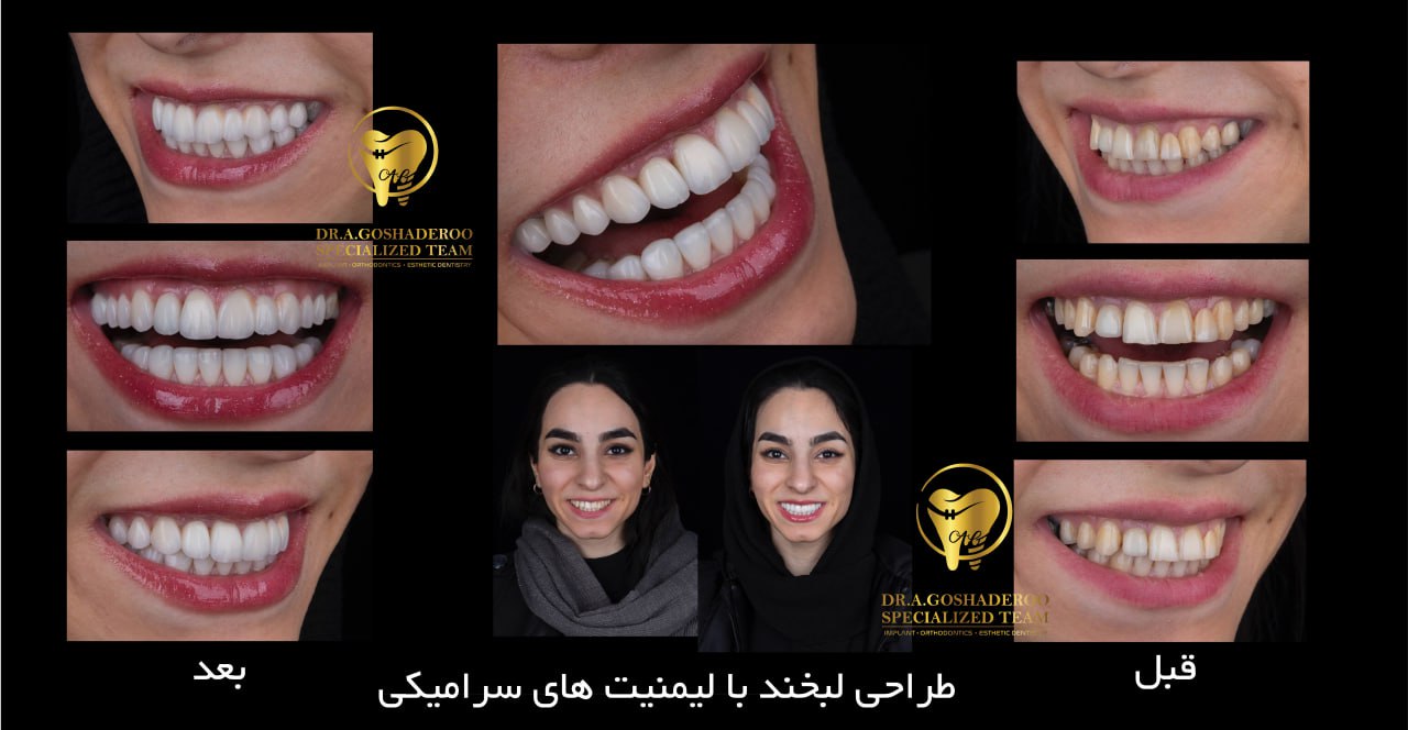 دندانپزشکی زیبایی