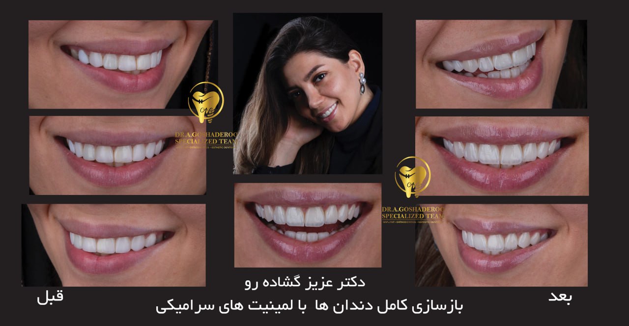 دندانپزشکی زیبایی