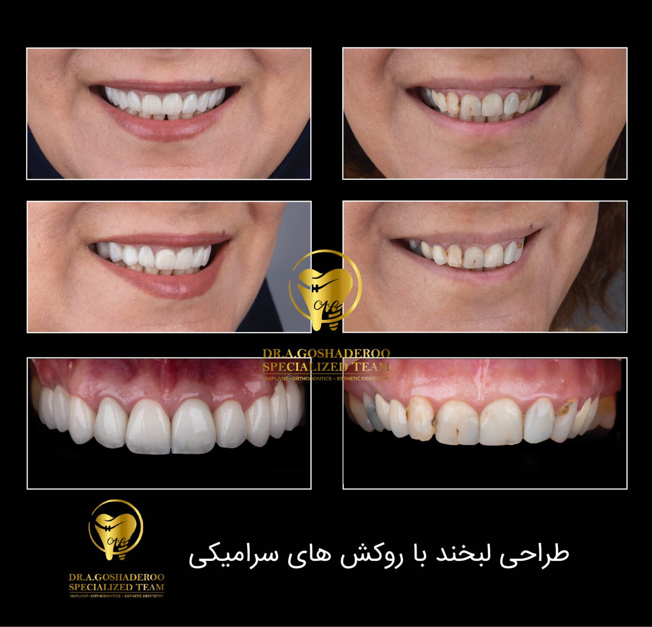 دندانپزشکی زیبایی