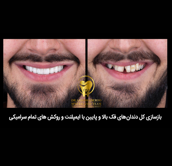 دندانپزشکی زیبایی