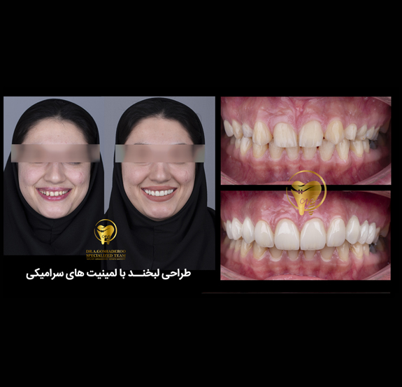 دندانپزشکی زیبایی