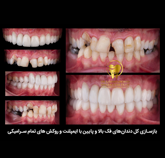 دندانپزشکی زیبایی