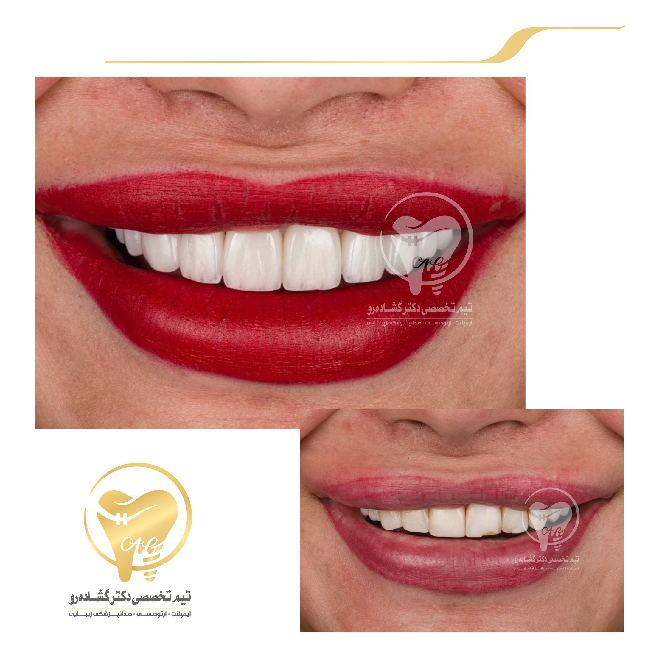 دندانپزشکی زیبایی