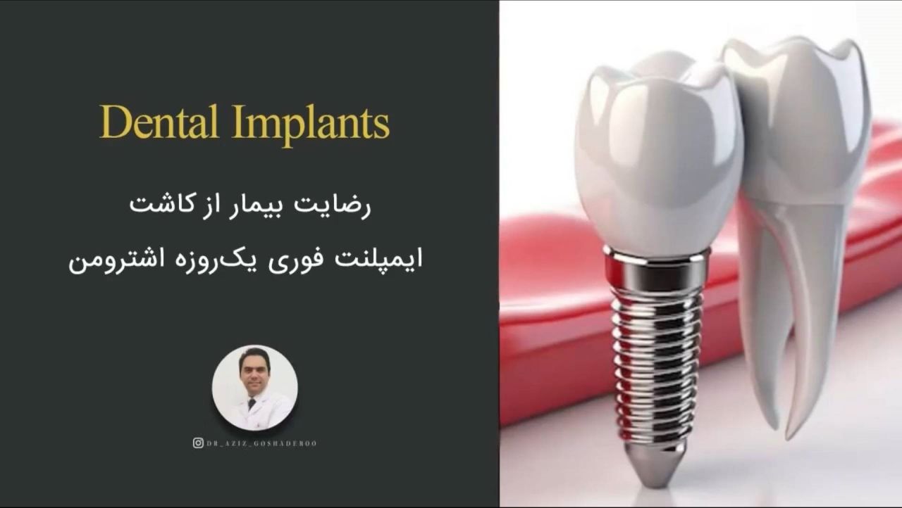 رضایت بیمار از کاشت ایمپلنت فوری یک روزه اشترومن
