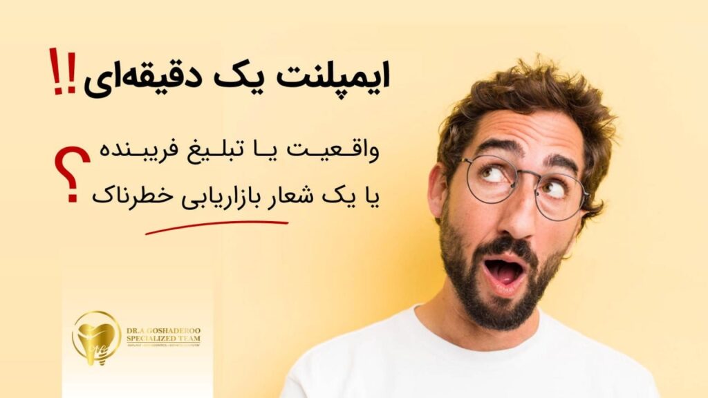 ایمپلنت یک دقیقهای