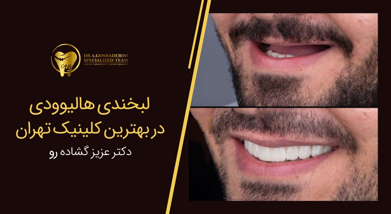 درمان و بازسازی دندان توسط متخصص پروتز دندان در تهران