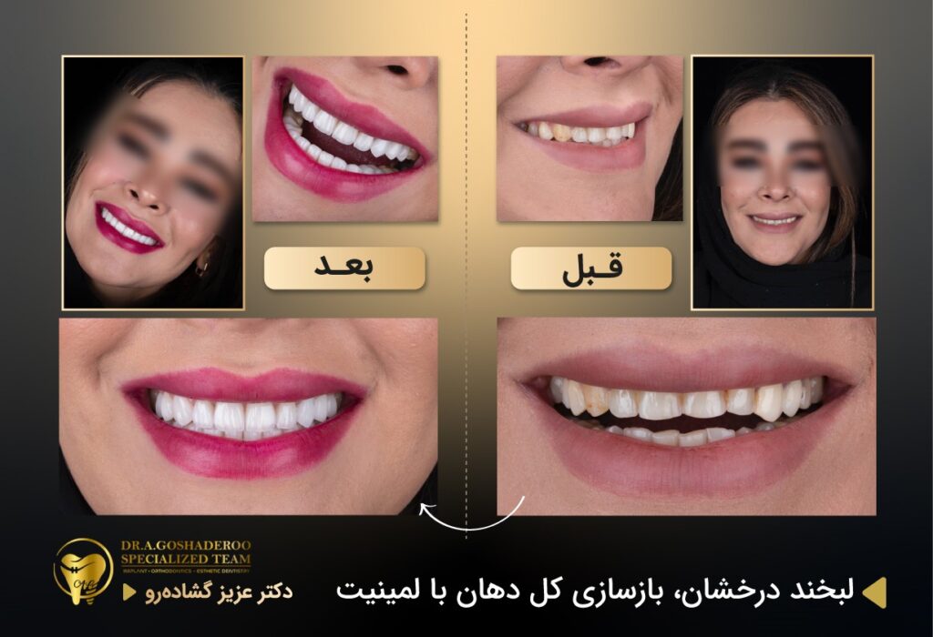کاربرد&nbsp;هوش مصنوعی AI در طراحی لبخند زیبا
