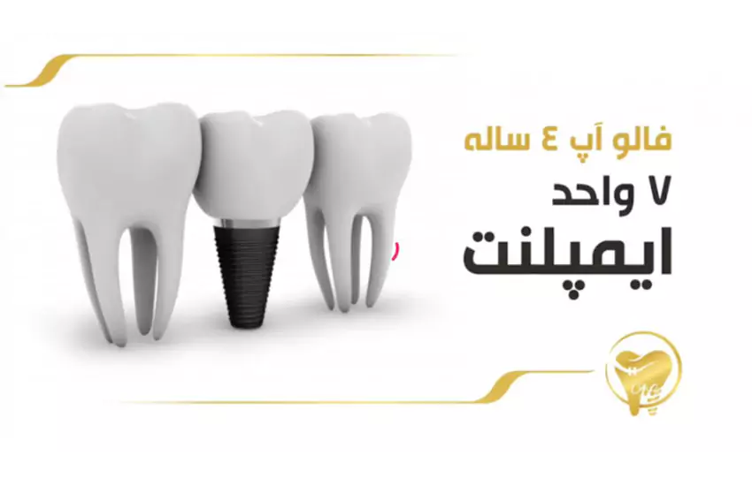 فالوآپ ۴ ساله ۷ واحد ایمپلنت