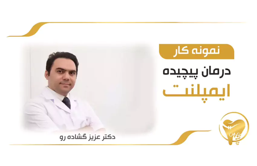 درمان پیچیده و موفق ایمپلنت