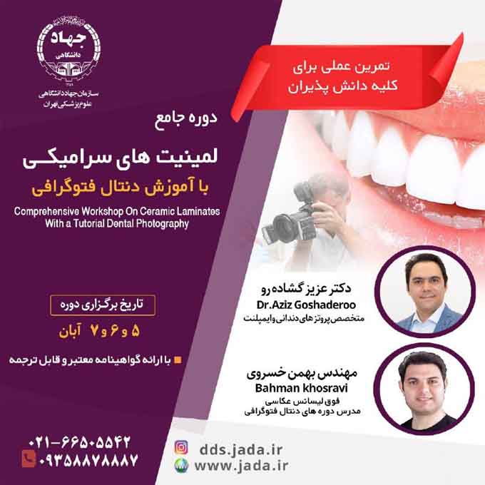 دوره جامع لمینت های سرامیکی