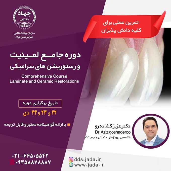 دوره جامع لمینت و رستوریشن های سرامیکی