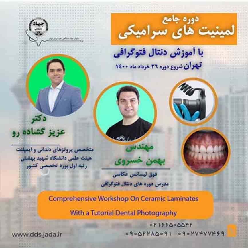 دوره جامع لمینت های سرامیکی تهران - 26 خرداد 1400