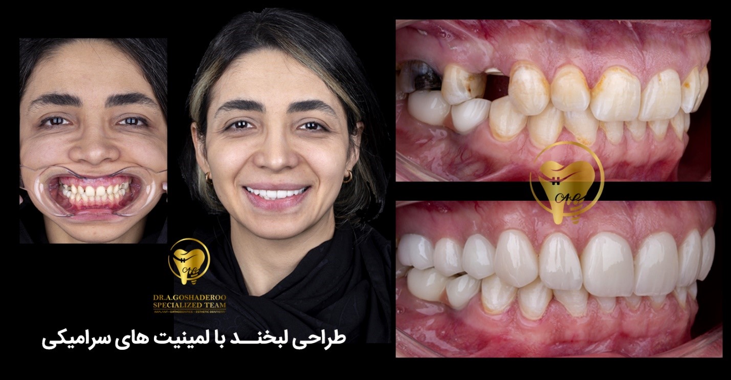 متخصص ایمپلنت دندان در الهیه