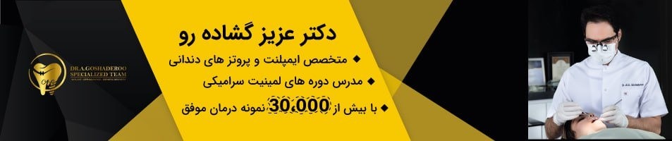 دکتر عزیز گشاده رو متخصص ایمپلنت