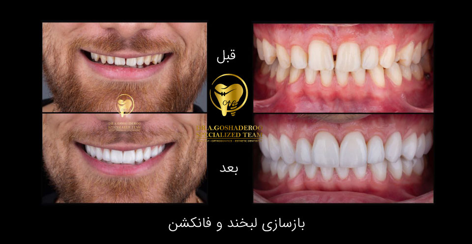 لبخند جذاب ، صورت جذاب