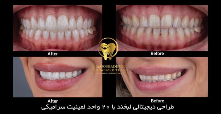 کاربرد&nbsp;هوش مصنوعی AI در طراحی لبخند زیبا