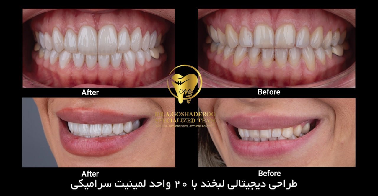 طراحی دیجیتالی لبخند