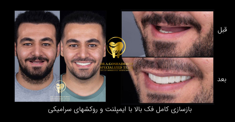 لبخند جذاب،صورت جذاب