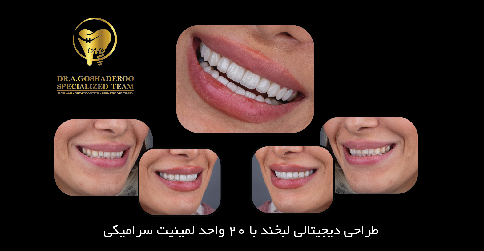 طراحی دیجیتالی لبخند