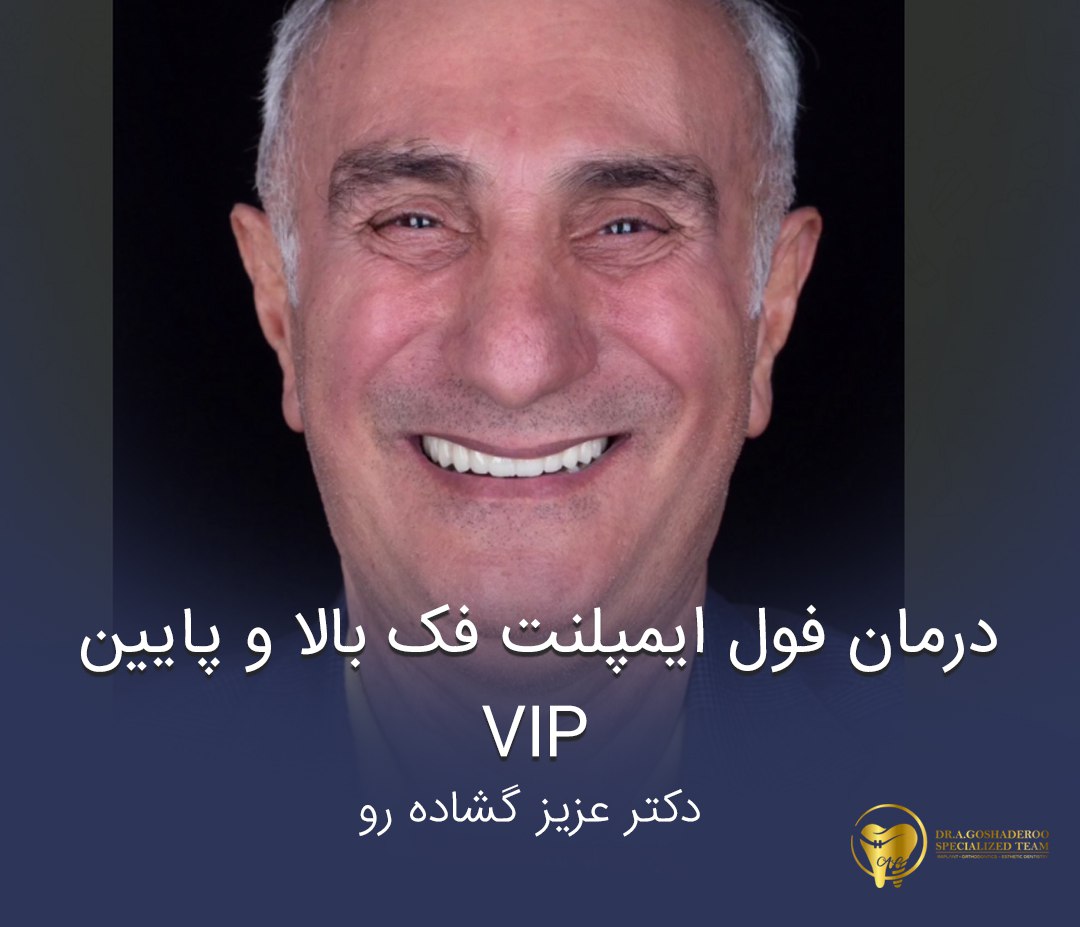 درمان فول ایمپلنت فک بالا و پایین vip