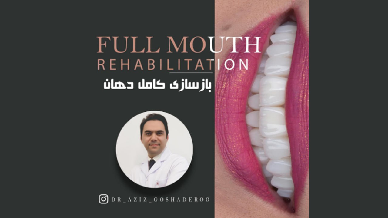 بازسازی لبخند و کل دهان با ترکیبی از درمانها
