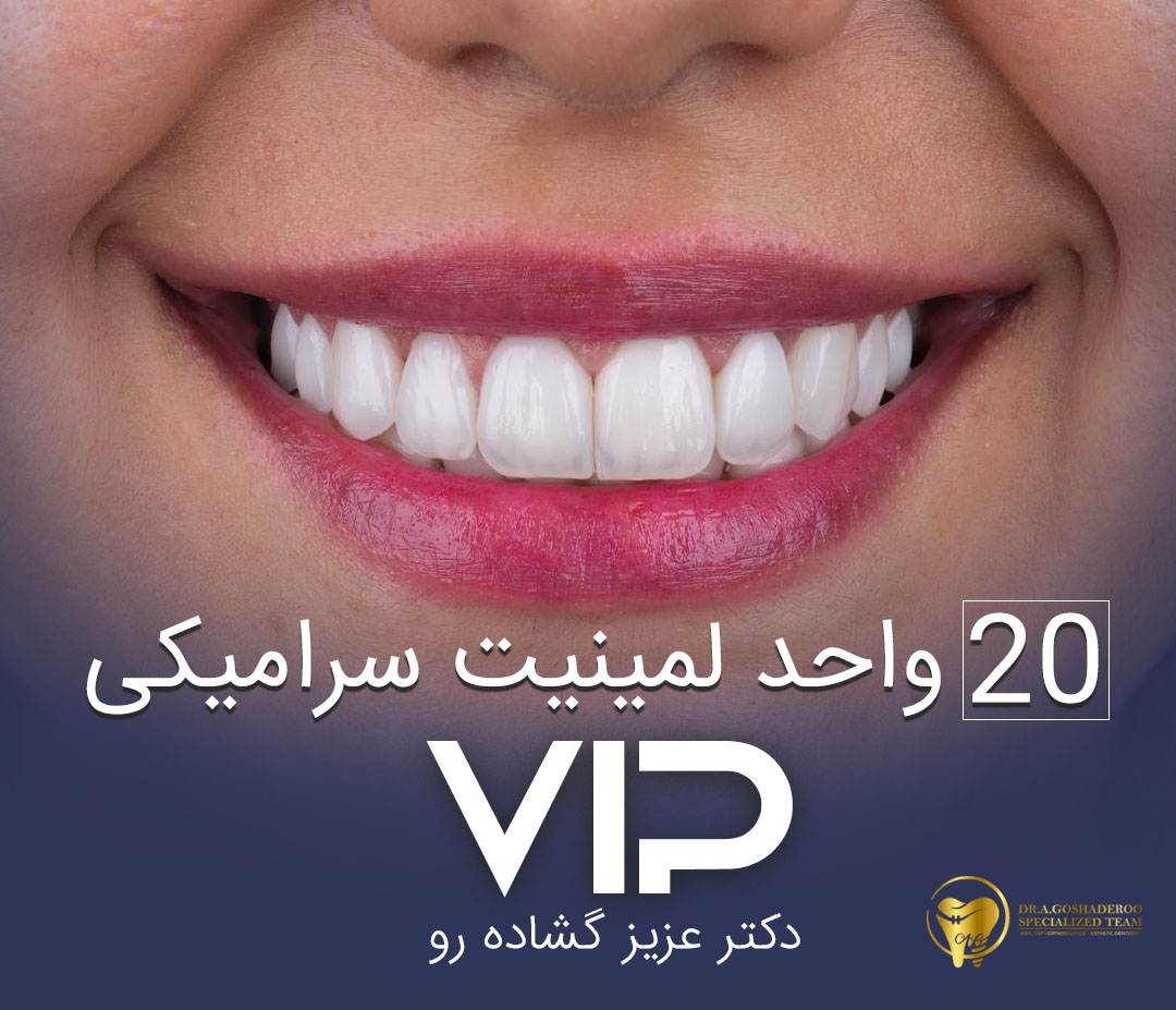 لیفت لثه و 20 واحد لمینیت سرامیکی